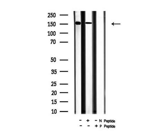 Phospho-CFTR (Ser737) Antibody in Western Blot (WB)