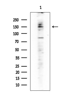 Phospho-DAPK1 (Ser308) Antibody in Western Blot (WB)