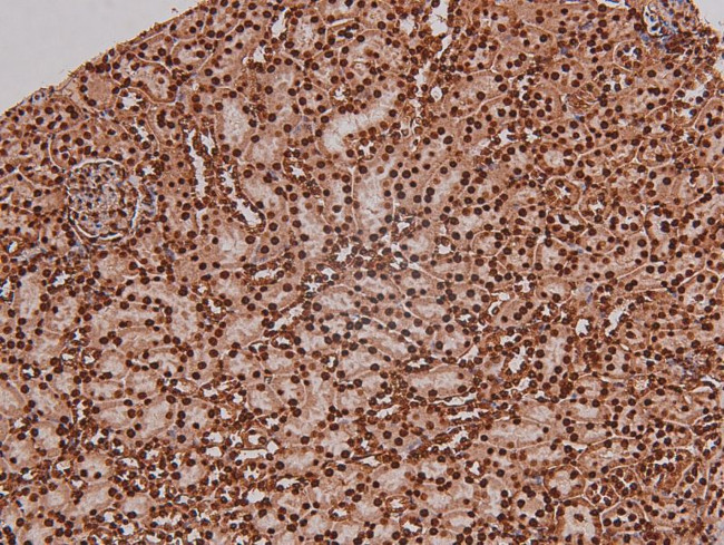 Phospho-RET (Tyr1096) Antibody in Immunohistochemistry (Paraffin) (IHC (P))