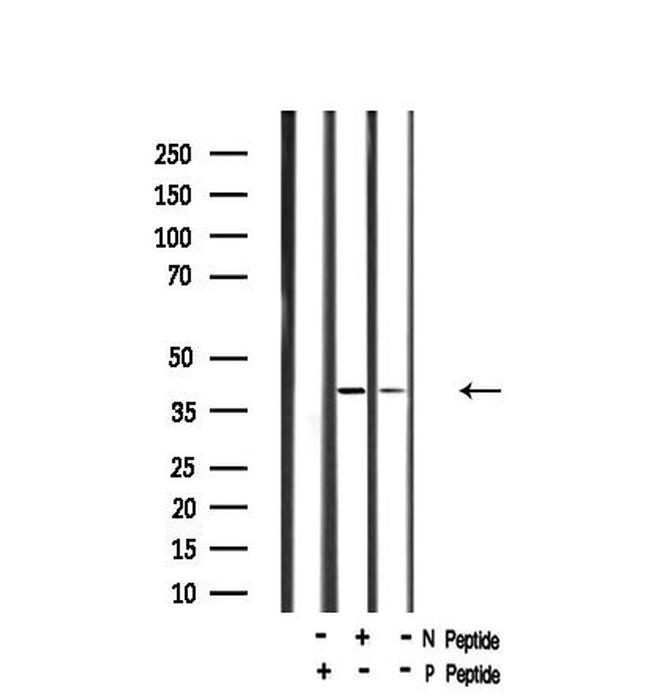 Phospho-GNAZ (Ser16) Antibody in Western Blot (WB)