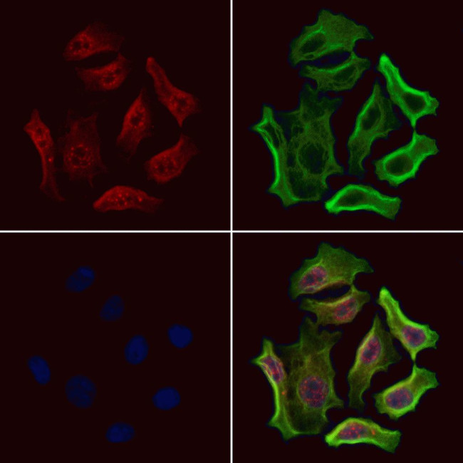 Phospho-HSF1 (Ser307) Antibody in Immunocytochemistry (ICC/IF)