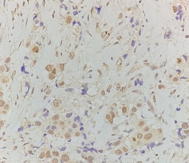 Phospho-HSF1 (Ser307) Antibody in Immunohistochemistry (Paraffin) (IHC (P))