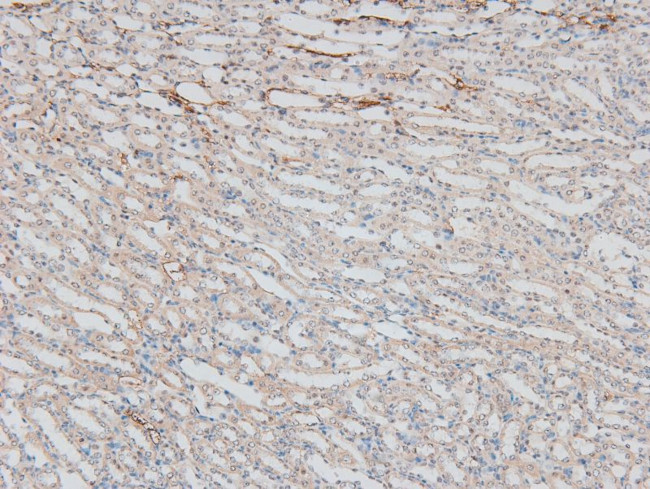 Phospho-HSF1 (Ser307) Antibody in Immunohistochemistry (Paraffin) (IHC (P))