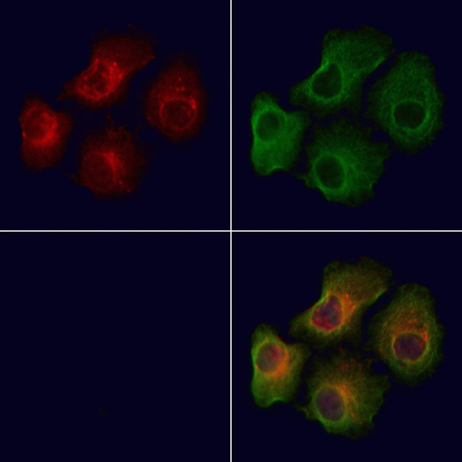 Phospho-MARK2 (Thr596) Antibody in Immunocytochemistry (ICC/IF)