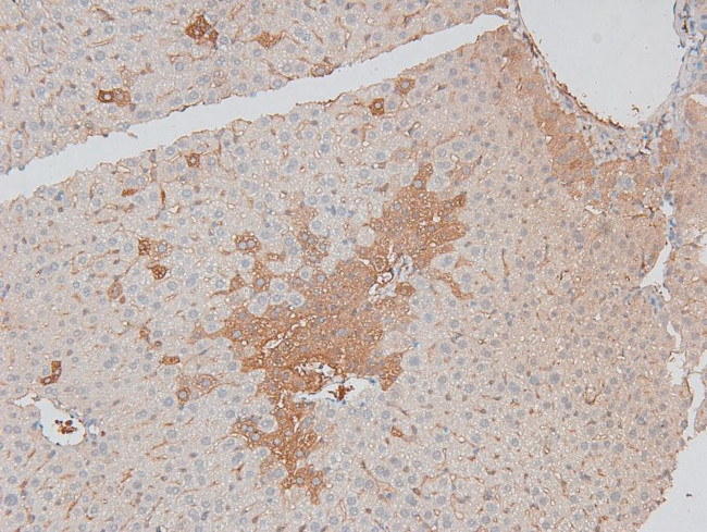 Phospho-MARK2 (Thr596) Antibody in Immunohistochemistry (Paraffin) (IHC (P))