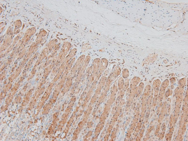 Phospho-MARK2 (Thr596) Antibody in Immunohistochemistry (Paraffin) (IHC (P))