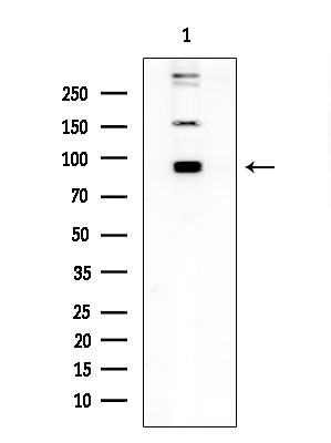 Phospho-TGFBR3 (Thr843) Antibody in Western Blot (WB)