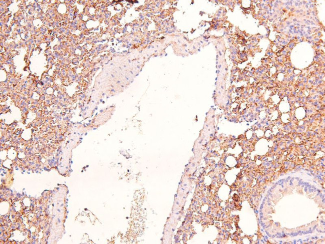 Phospho-KIF1C (Ser1092) Antibody in Immunohistochemistry (Paraffin) (IHC (P))