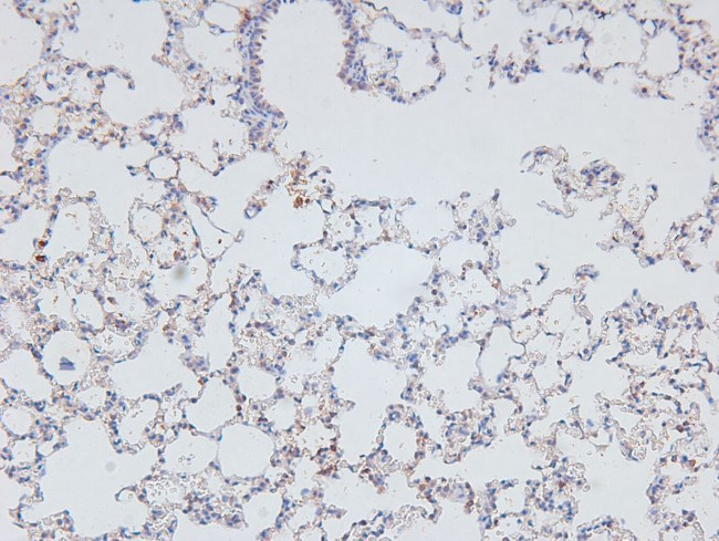 Phospho-KIF1C (Ser1092) Antibody in Immunohistochemistry (Paraffin) (IHC (P))