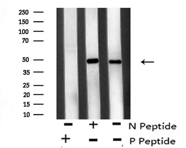 Phospho-ATF4 (Ser219) Antibody in Western Blot (WB)