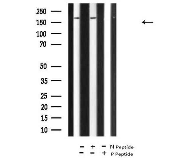 Phospho-DAPK1 (Ser289) Antibody in Western Blot (WB)