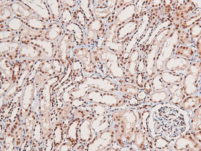 Phospho-HIPK1/HIPK2/HIPK3 (Tyr352, Tyr361, Tyr359) Antibody in Immunohistochemistry (Paraffin) (IHC (P))