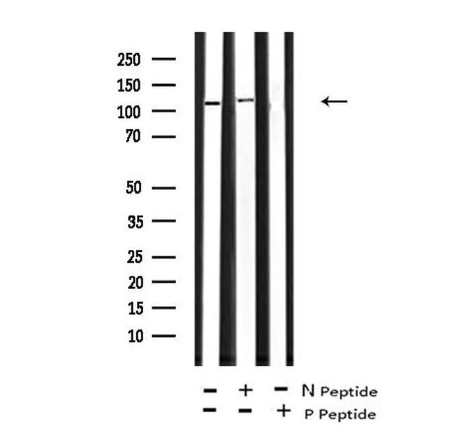 Phospho-JAK2/JAK3 (Tyr966, Tyr939) Antibody in Western Blot (WB)