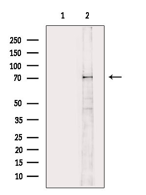 Phospho-MEKK2 (Ser520) Polyclonal Antibody (PA5-105898)