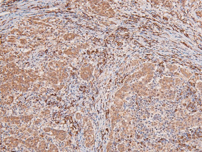 Phospho-MNK1 (Thr250) Antibody in Immunohistochemistry (Paraffin) (IHC (P))