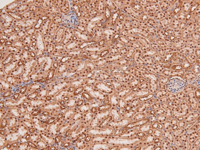 Phospho-MNK1 (Thr250) Antibody in Immunohistochemistry (Paraffin) (IHC (P))