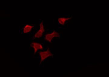 Phospho-p70 S6 Kinase (Ser427) Antibody in Immunocytochemistry (ICC/IF)