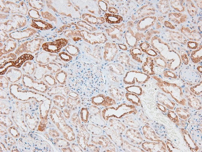 Phospho-p70 S6 Kinase (Ser427) Antibody in Immunohistochemistry (Paraffin) (IHC (P))