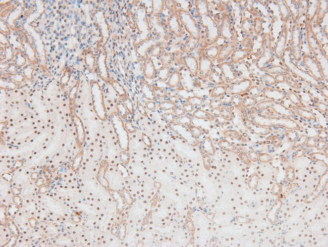 Phospho-p70 S6 Kinase (Ser427) Antibody in Immunohistochemistry (Paraffin) (IHC (P))