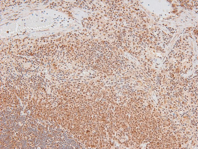 Phospho-p70 S6 Kinase (Ser427) Antibody in Immunohistochemistry (Paraffin) (IHC (P))