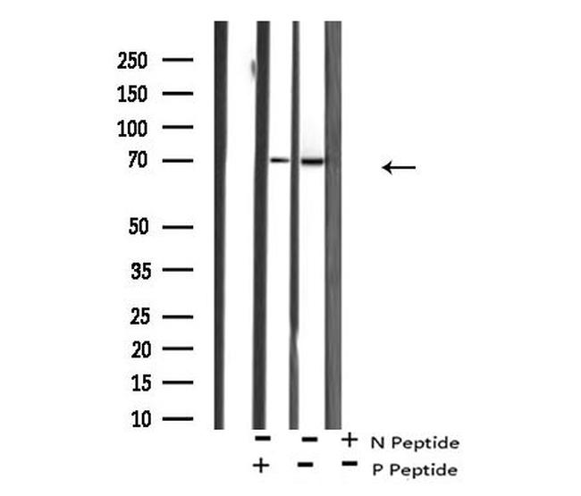 Phospho-p70 S6 Kinase (Ser427) Antibody in Western Blot (WB)