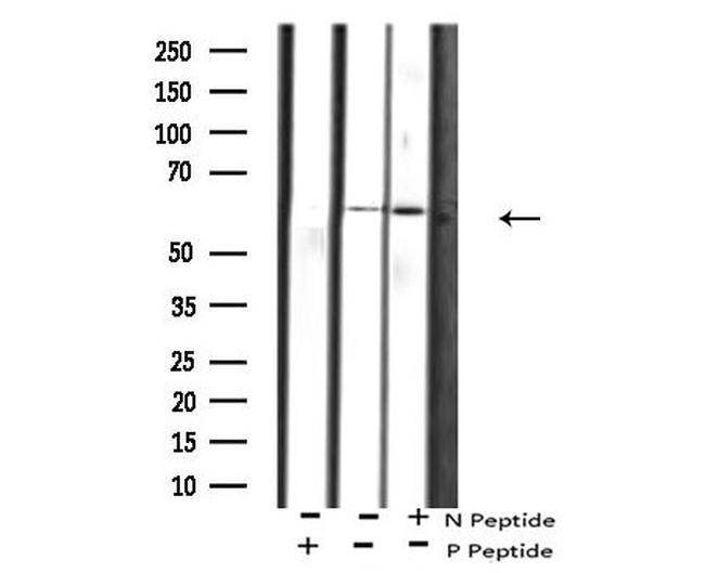 Phospho-PAK1 (Ser21) Antibody in Western Blot (WB)