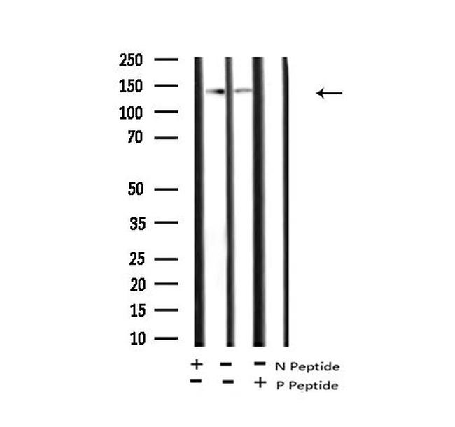 Phospho-PASK (Thr1165) Antibody in Western Blot (WB)