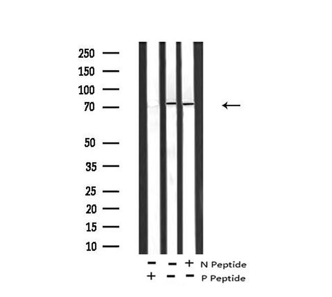 Phospho-cGKII (Ser126) Antibody in Western Blot (WB)