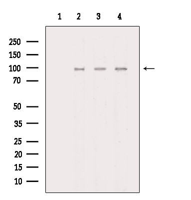 Phospho-ZAK (Ser165) Antibody in Western Blot (WB)