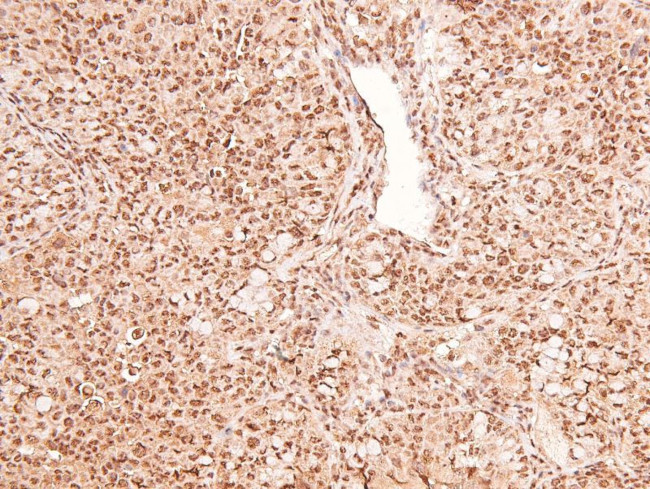 Phospho-RET (Tyr1015) Antibody in Immunohistochemistry (Paraffin) (IHC (P))