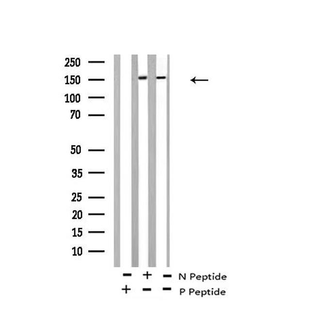 Phospho-RET (Tyr1015) Antibody in Western Blot (WB)