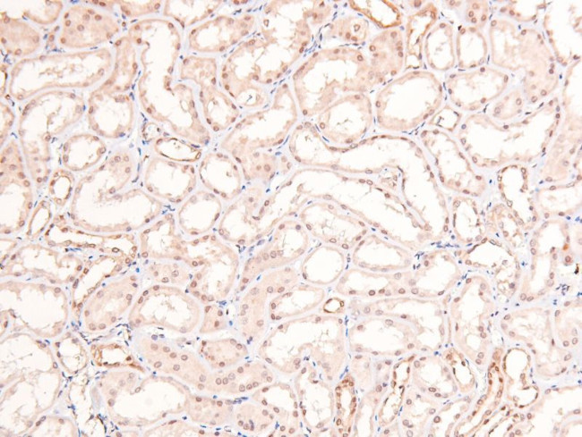 Phospho-RARA/RARB (Ser96) Antibody in Immunohistochemistry (Paraffin) (IHC (P))