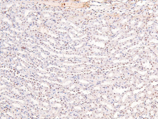 Phospho-RARA/RARB (Ser96) Antibody in Immunohistochemistry (Paraffin) (IHC (P))