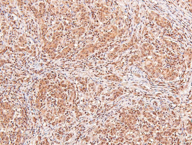 Phospho-CD22 (Tyr842) Antibody in Immunohistochemistry (Paraffin) (IHC (P))