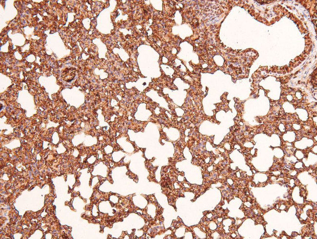 Phospho-CD22 (Tyr842) Antibody in Immunohistochemistry (Paraffin) (IHC (P))