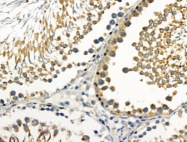 Phospho-Leptin Receptor (Tyr1141) Antibody in Immunohistochemistry (Paraffin) (IHC (P))