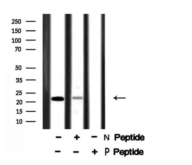 Phospho-Claudin 1 (Tyr210) Antibody in Western Blot (WB)