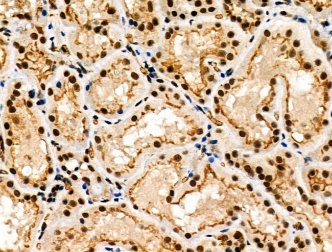 Phospho-MKP-1 (Ser323) Antibody in Immunohistochemistry (Paraffin) (IHC (P))