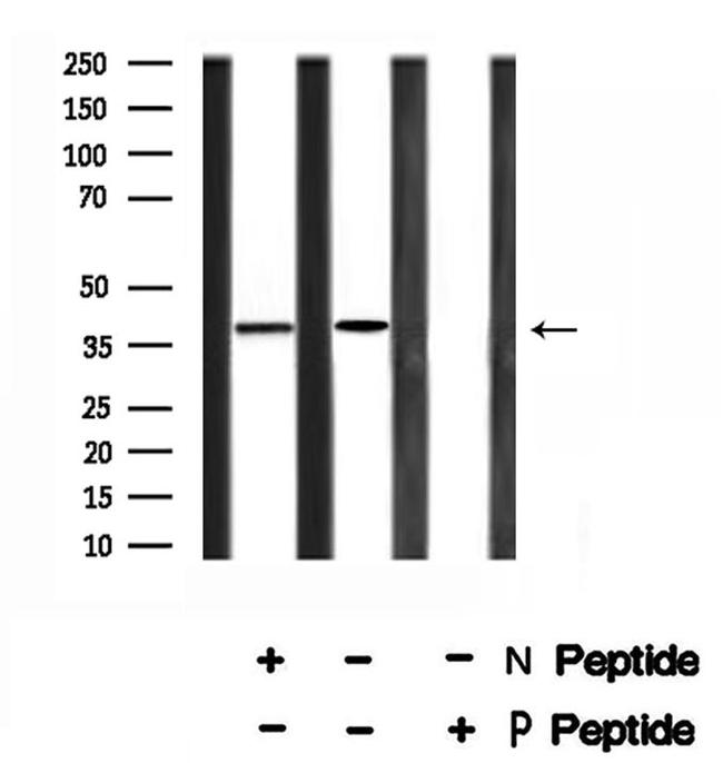 Phospho-MKP-1 (Ser323) Antibody in Western Blot (WB)