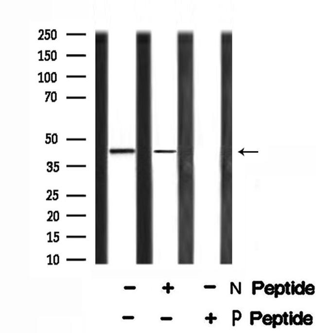 Phospho-MKP3 (Ser197) Antibody in Western Blot (WB)