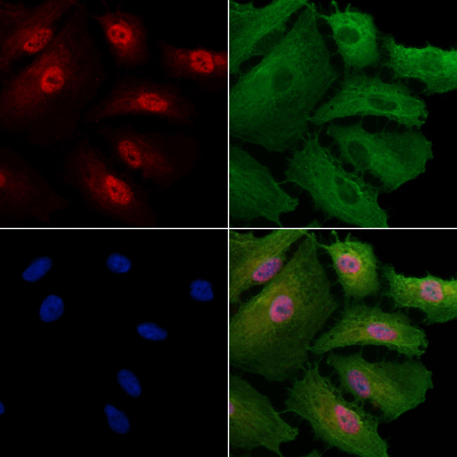 Phospho-NFATC1 (Ser172) Antibody in Immunocytochemistry (ICC/IF)