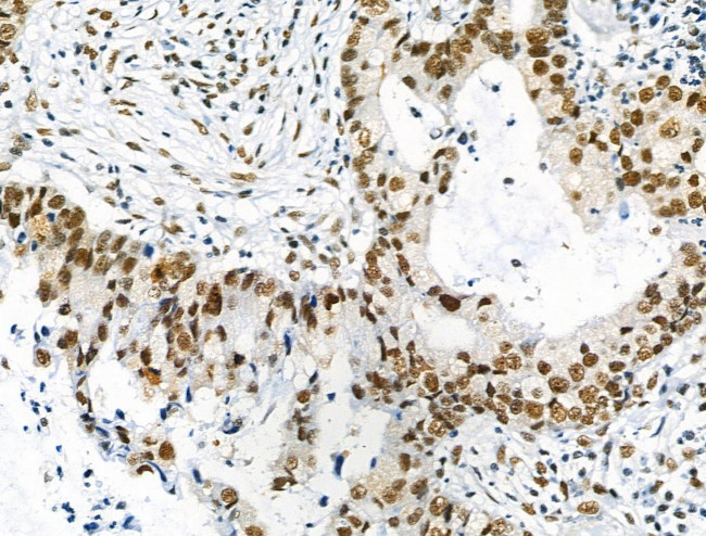 Phospho-NFATC1 (Ser172) Antibody in Immunohistochemistry (Paraffin) (IHC (P))