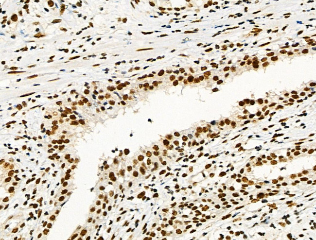 Phospho-NFATC1 (Ser172) Antibody in Immunohistochemistry (Paraffin) (IHC (P))