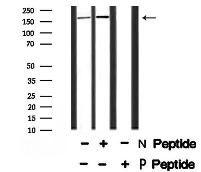 Phospho-TRAP220 (Thr1032) Antibody in Western Blot (WB)