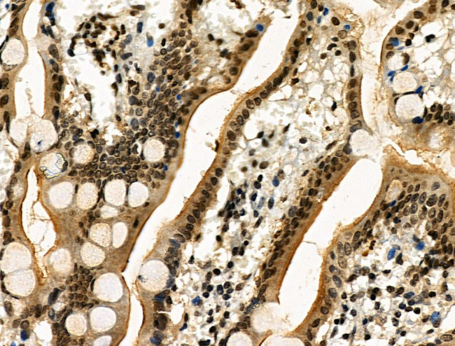 Phospho-RAD17 (Ser646) Antibody in Immunohistochemistry (Paraffin) (IHC (P))