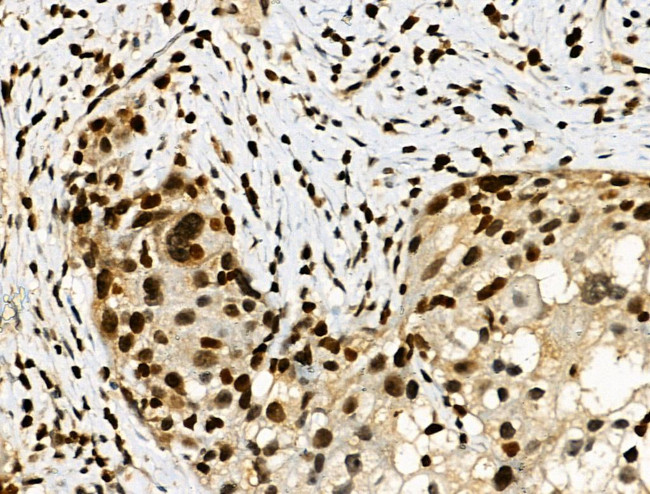 Phospho-RAD17 (Ser646) Antibody in Immunohistochemistry (Paraffin) (IHC (P))