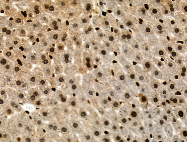 Phospho-RAD17 (Ser646) Antibody in Immunohistochemistry (Paraffin) (IHC (P))