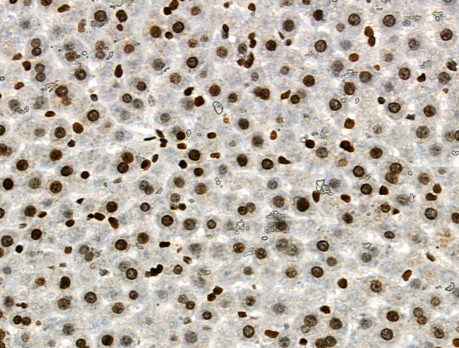 Phospho-RAD17 (Ser646) Antibody in Immunohistochemistry (Paraffin) (IHC (P))