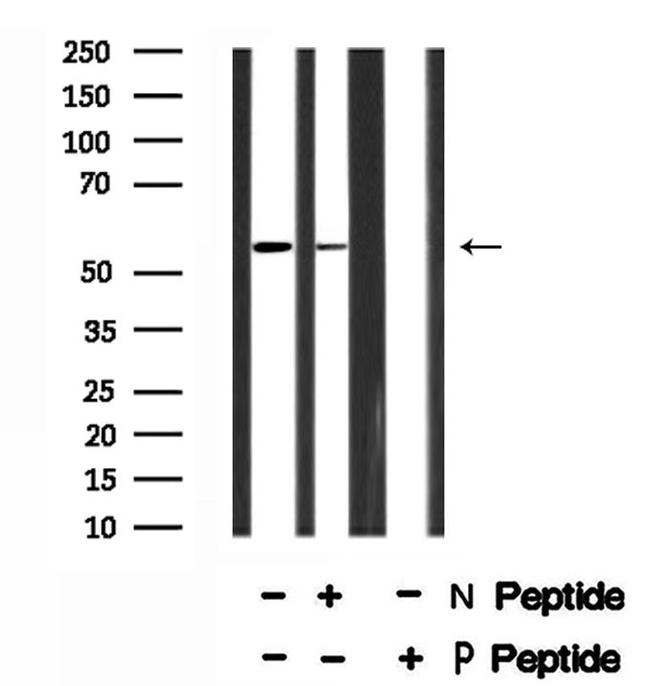 Phospho-SRF (Thr159) Antibody in Western Blot (WB)