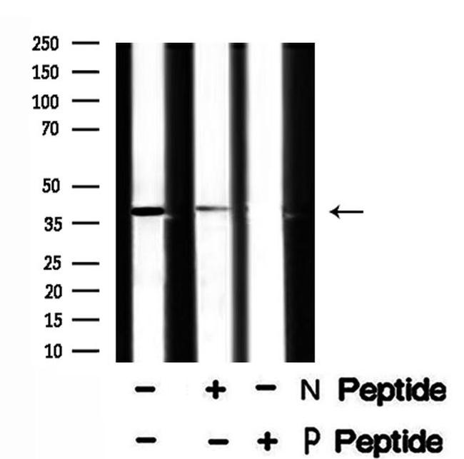 Phospho-XRCC4 (Ser260) Antibody in Western Blot (WB)